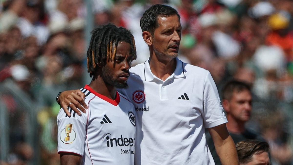 Le coach de l’Eintracht n’en peut vraiment plus d’Elye Wahi