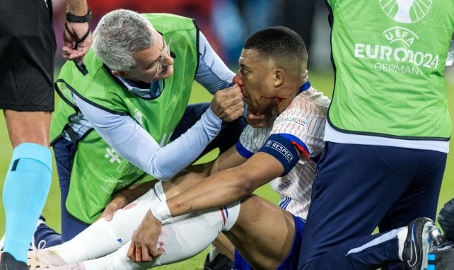 Kylian Mbappé blessé au nez face à la Suisse
