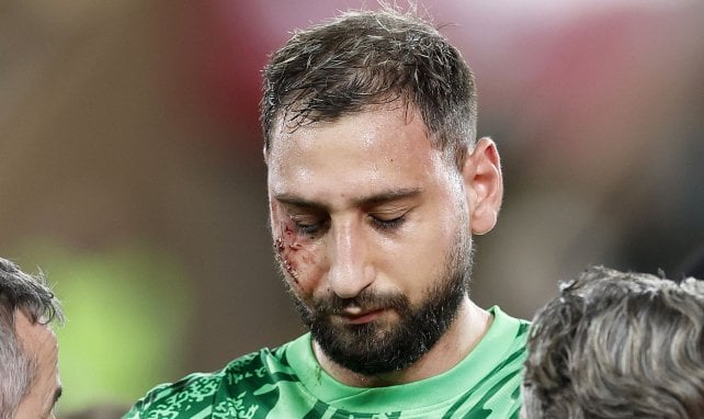 Gianluigi Donnarumma, touché face à Monaco