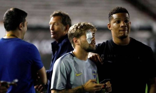 Gonzalo Lamardo a été blessé hier suite à l'attaque du bus de Boca Juniors